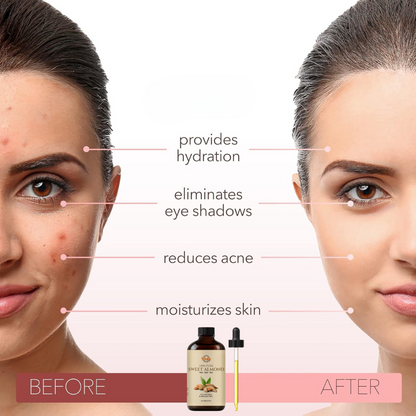 Sweet Almond Oil - 30ML - 100% Pure and Natural - Premium Grade Carrier & Essential Oil